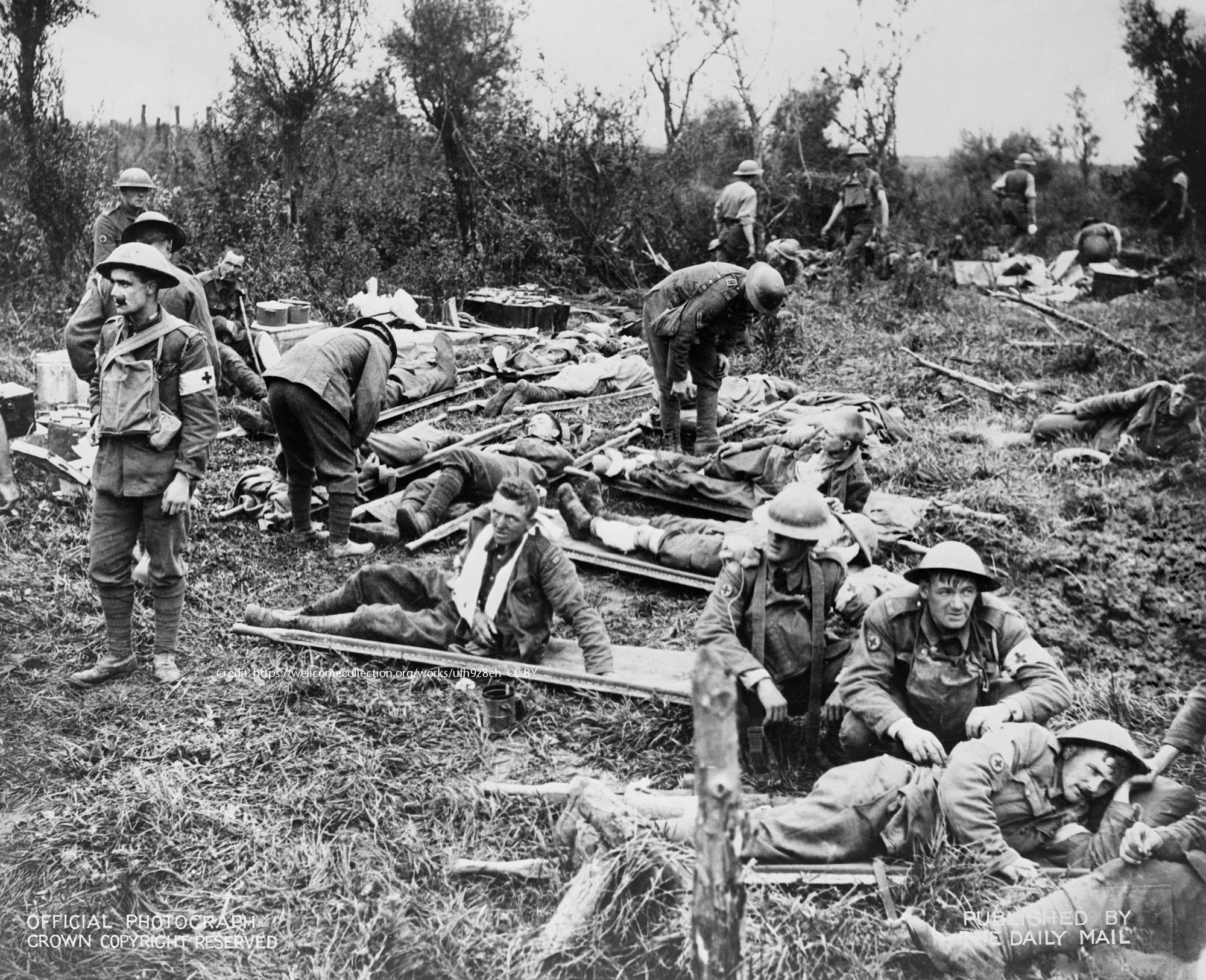 World War I: advance dressing station in the field Credit: https://wellcomecollection.org/works/ufh9z8eh  CC BY